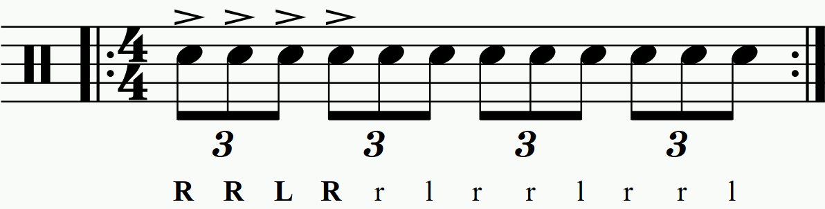 Accenting a reverse triplet.